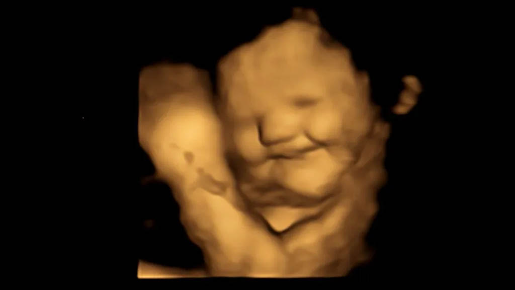Una imagen de escáner 4D de un feto muestra una reacción de sonrisa tras ser expuesto al sabor de la zanahoria. Crédito: FETAP/Laboratorio de Investigación Fetal y Neonatal/Universidad de Durham