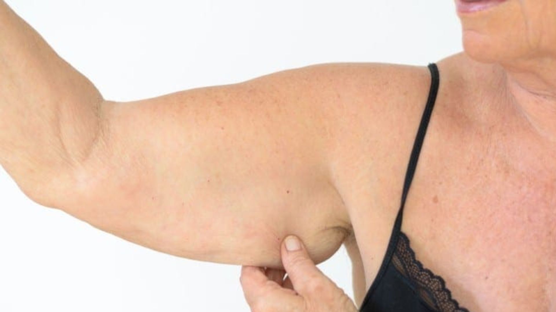 La sarcopenia es una enfermedad que conlleva pérdida de masa, fuerza y función muscular. Foto: Canva edit,