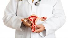 Foto: Oncosalud